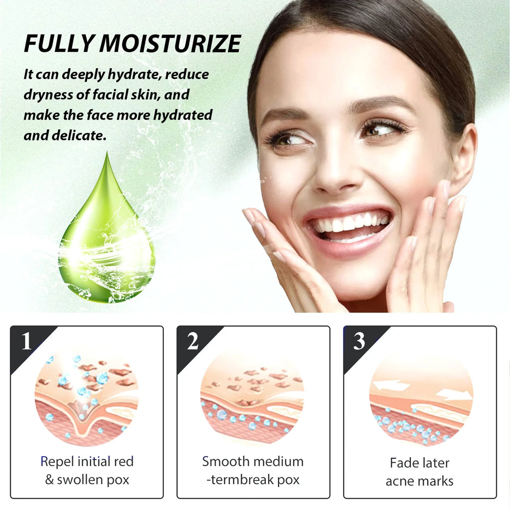 Acne Face Cream Pimple Treatment Oil Control Repair Redness Remove Blackhead Smooth Hydrating Moisturizing Pore Shrinking Serum Qme