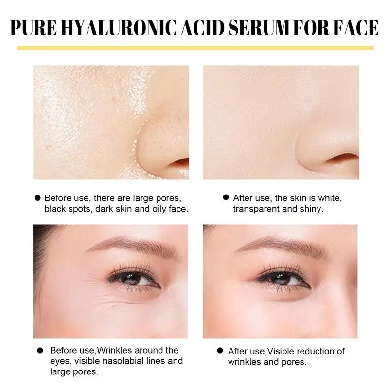 Collagen Protein Thread Instant Wrinkle Remover Serum Set Lifting Firming Soluble Absorbable Face Filler Anti-aging Skin Care Qme