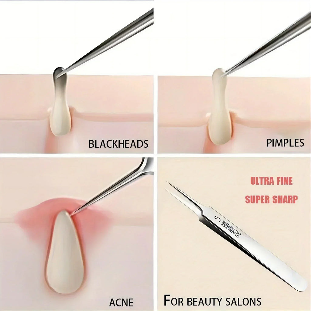 Professional Extra Fine No 5 Cellular Acne Blackhead Tweezers Facial Qme