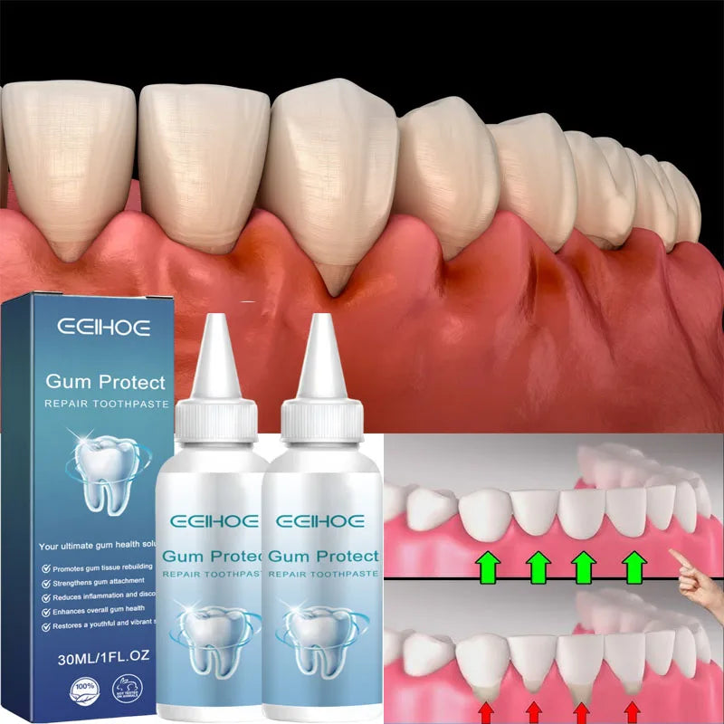 Damaged Gum Relief Care Toothpaste Deep Cleaning Effectively Reduce Yellow Teeth Stains Tartar Fresh Breath Teeth Cleaning Serum Qme 2pc
