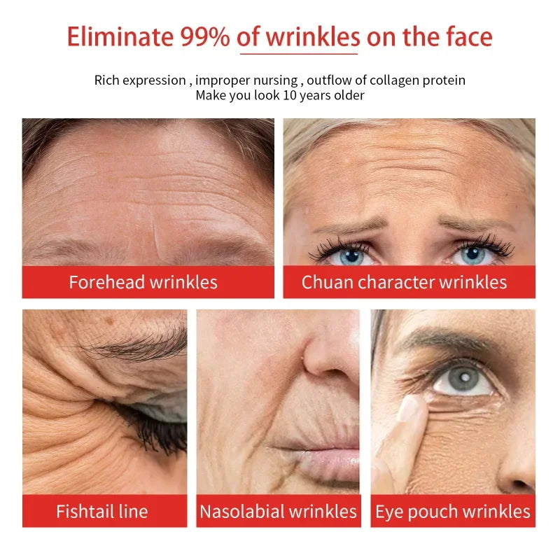 Retinol Wrinkle Removing Face Cream Anti-Aging Firming Lifting Fade Fine Lines Moisturizing Brighten Skin Care Korean Cosmetics Qme