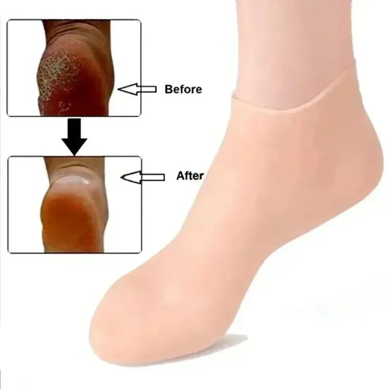 Spa Silicone Moisturizing Gloves Socks Hands Feet Care Prevents Dry Qme