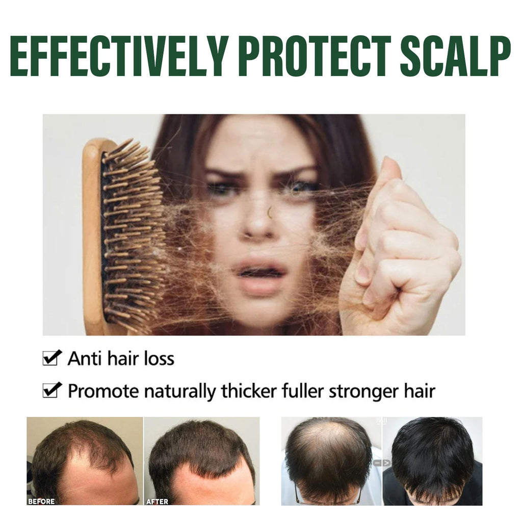 Hair Shampoo Anti-dandruff Oil Control Fluffy Refreshing Deep Qme