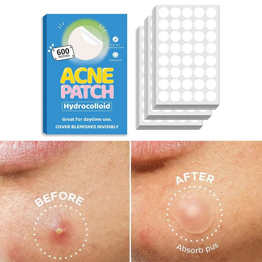 Invisible Hydrocolloid Patches For Covering Zits And Blemishes, Acne Pimple Patches For Face Spot Stickers For All Skin Types Qme
