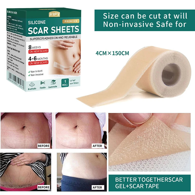 1 Roll Silicone Scar Sheets Gel Patch 4cmX150cm Self-adhesive Cover Qme