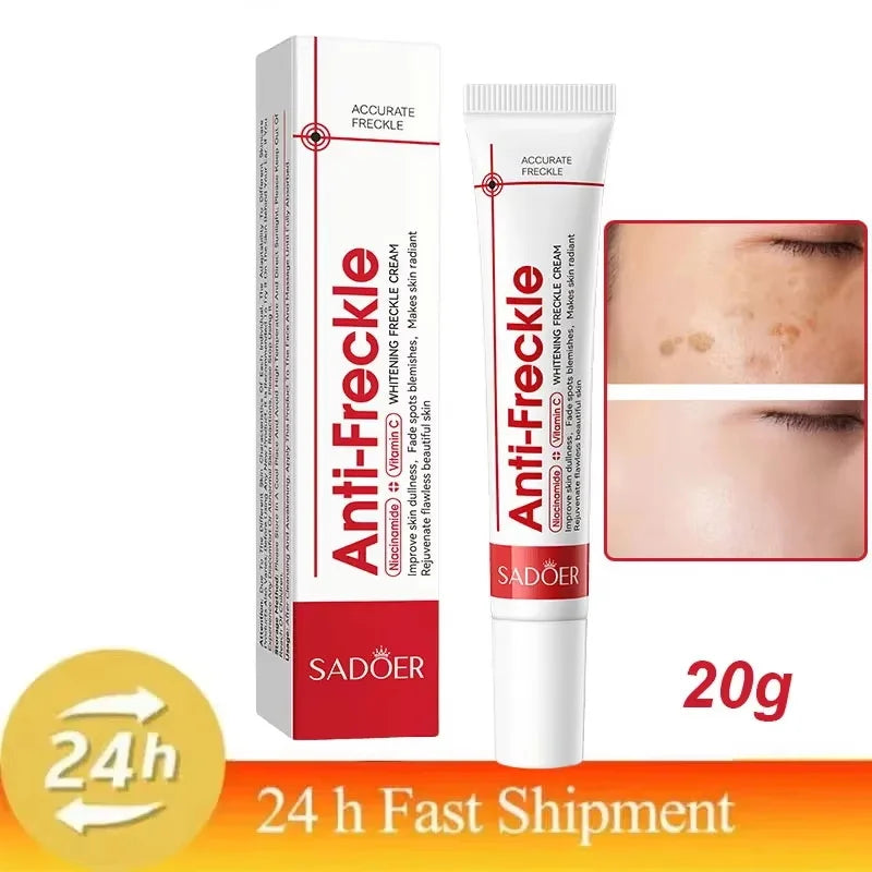Whitening Freckle Cream Reduce Dark Spots Anti Freckle Face Creams Niacinamide Fade Pigmentation Melasma Brighten Skin Care 20g Qme 1pc