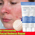 Facial Redness Reduce Cream Improve Sensitive Skin Dryness Moisturizer Hydrating Sooth Lotion Rosacea Decrease Korean Cosmetics Qme 1pc