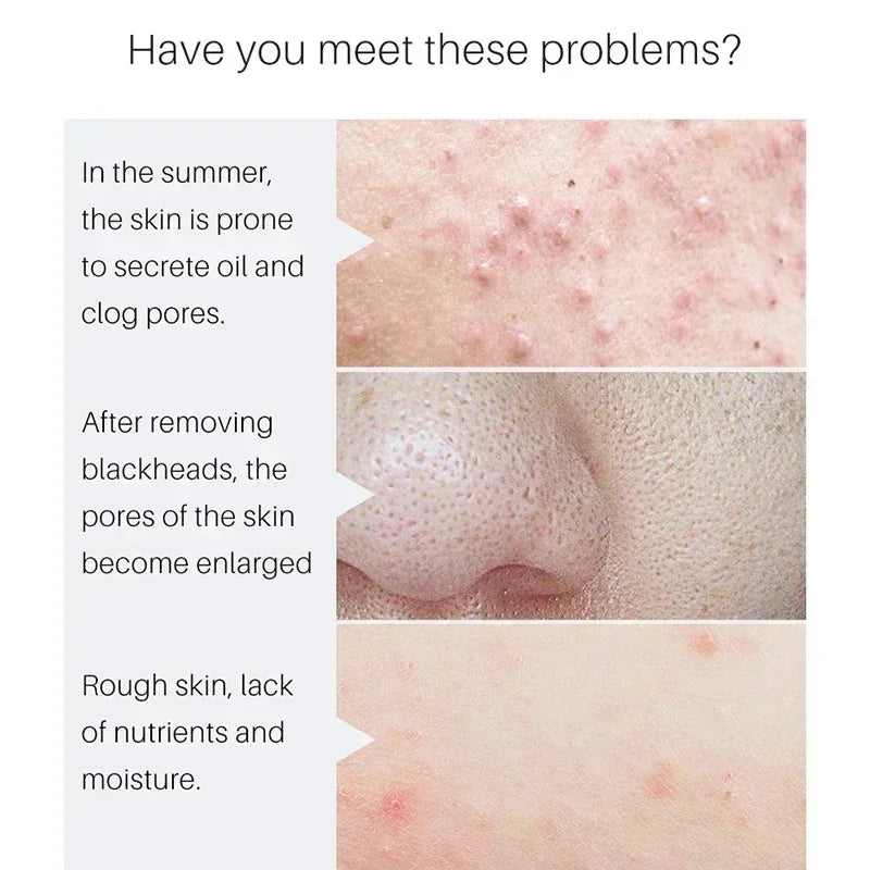 Remove Large Pores Serum Lactic Acid Facial Pore Shrinking Repairing Qme