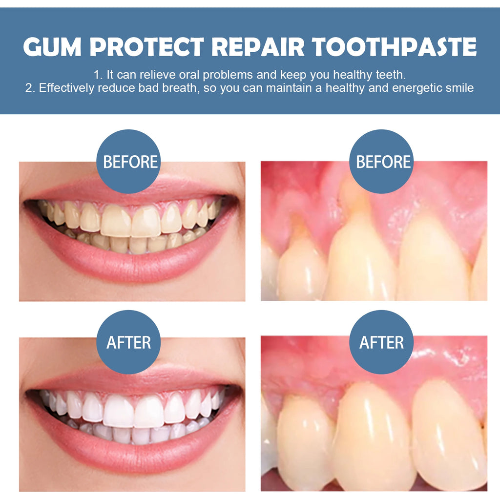 Damaged Gum Relief Care Toothpaste Deep Cleaning Effectively Reduce Yellow Teeth Stains Tartar Fresh Breath Teeth Cleaning Serum Qme