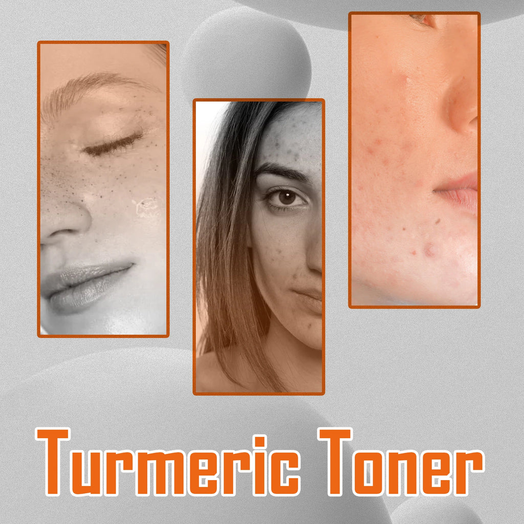 Turmeric Toner Dark Spots Removal Brightening Spots Corrector Remove Freckle Fade Melasma Moisturizing Turmeric Face Toner Qme