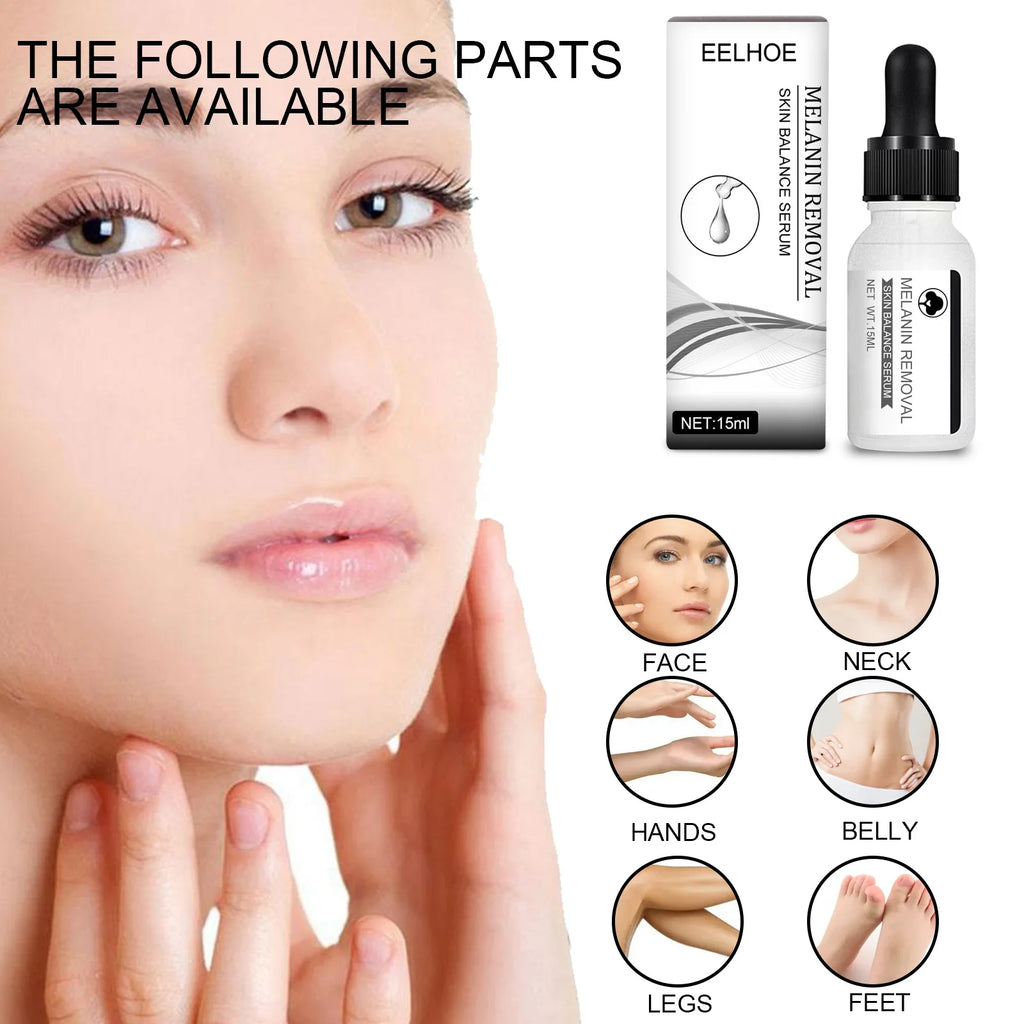 Niacinamide Spot Removal Essence Fade Dark Spot Freckle Melasma Melanin Removal Moisturizing Brighten Skin Tone Facial Cream Qme