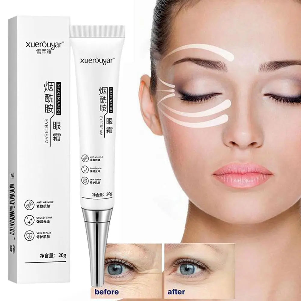 3pcs Nicotinamide Whitening Freckles Cream Remove Melasma Dark Spot Acne Marks Brightening Skin Tone Face Skin Care Qme white 1pc
