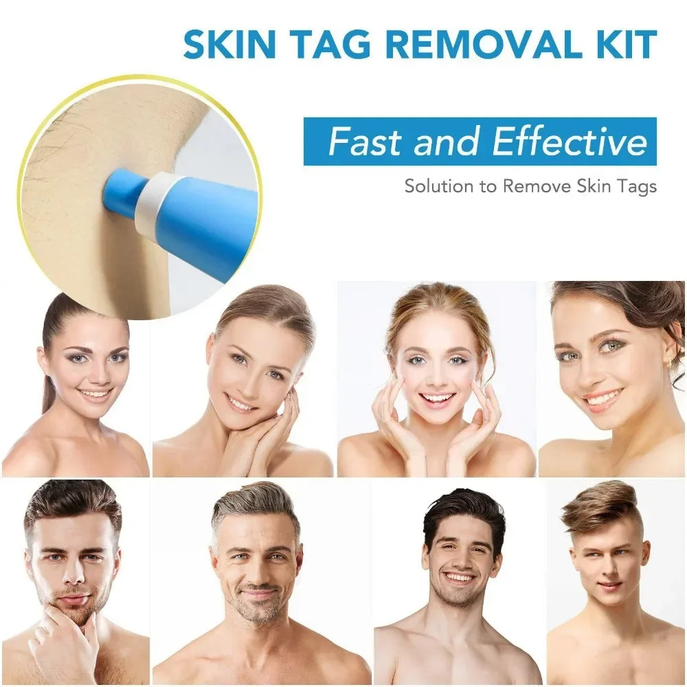 2 In1 Painless Auto Skin Tag Mole Wart Removal Cleaning Tools Face Qme