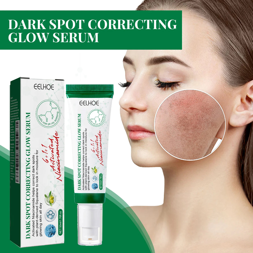Nicotinamide Dark Spot Corrector Facial Serum Fade Melanin Acne Freckles Removal Brightening Improve Dull Face Care Essence Qme