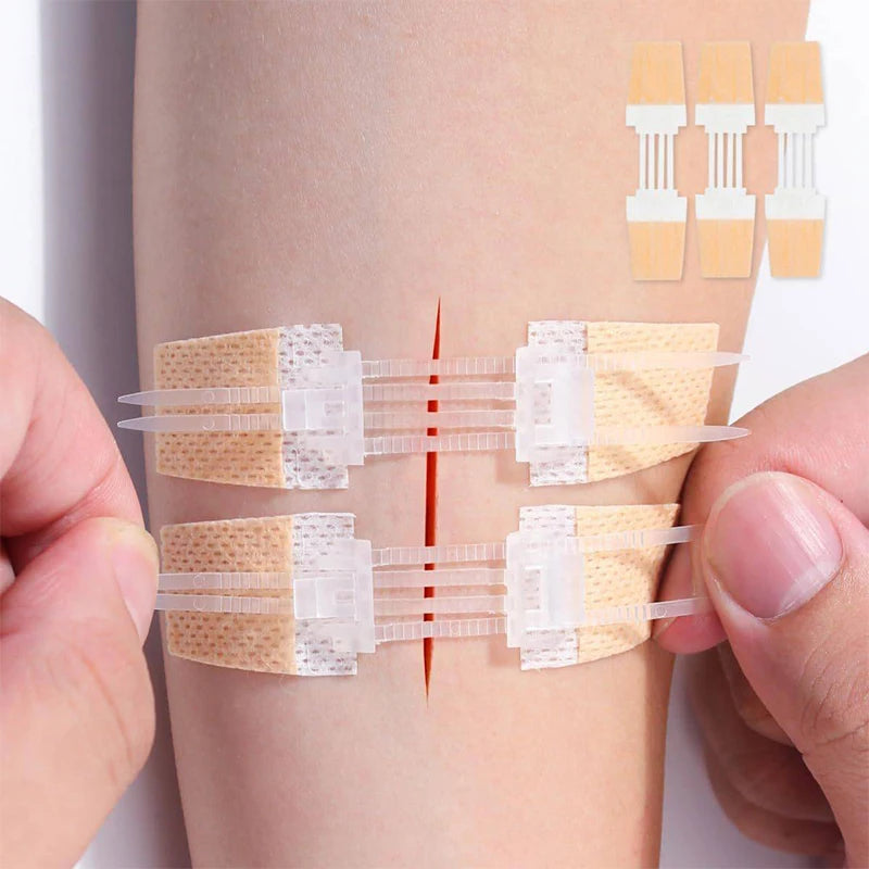 Zipper Band Aid Painless Wound Closure Patch Sutureless Waterproof Qme
