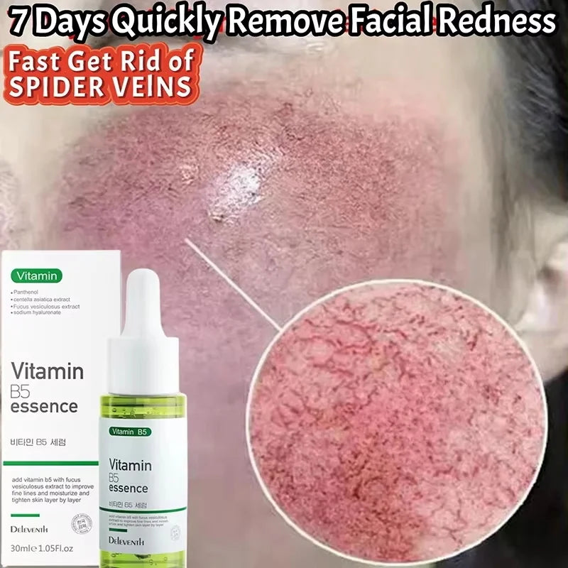 Facial Redness Repair Serum Improve Sensitive Skin Dryness Moisturizer Hydrating Sooth Lotion Removal Rosacea Korean Cosmetics Qme