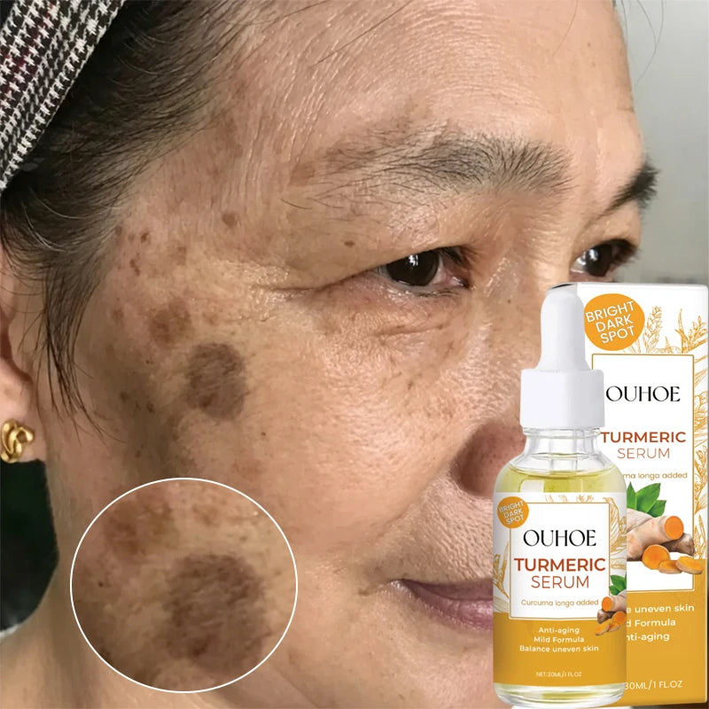 Turmeric Face Serum Repair Melanin Freckle Pigment Correcting Brighten Lightening Moisturizer Nourish Smooth Shrink Pore Essence Qme