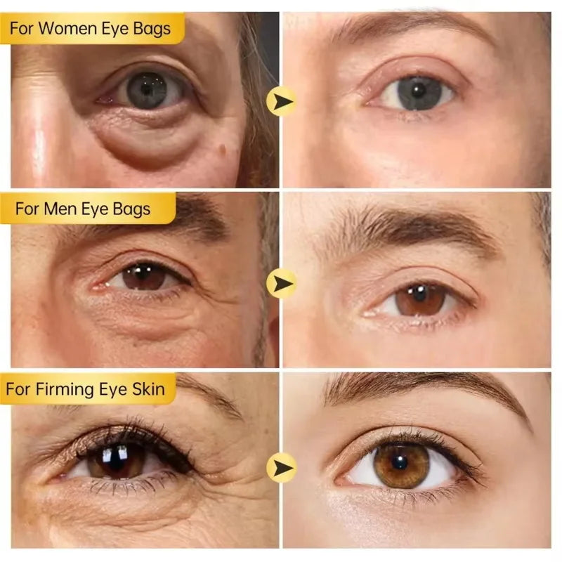 Instant Eye Bag Removal Cream Collagen Anti-Wrinkle Fade Fine Lines Firming Skin Anti Dark Circle Puffiness Brighten Eye Care Qme