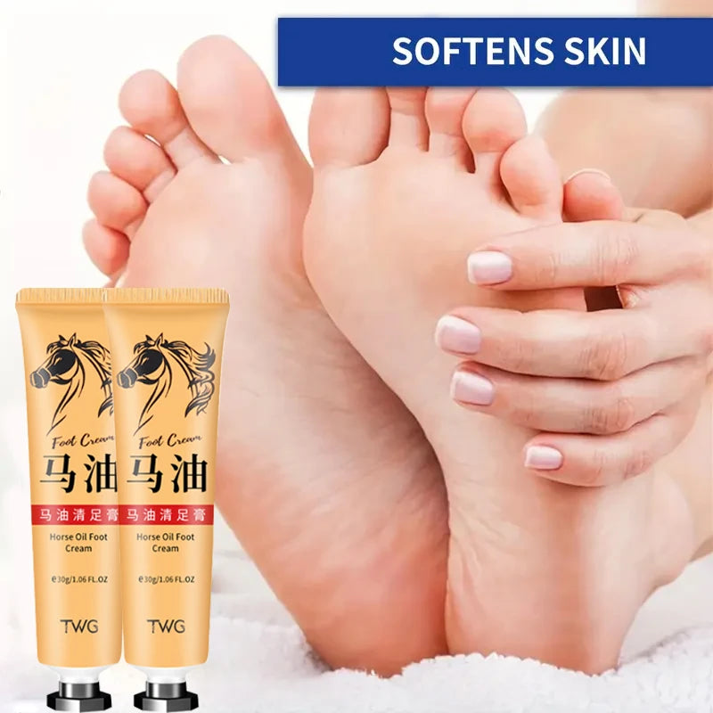 Ma You Qing Foot Cream Moisturizing Suitable Dry Skin Hand Care Hands Qme