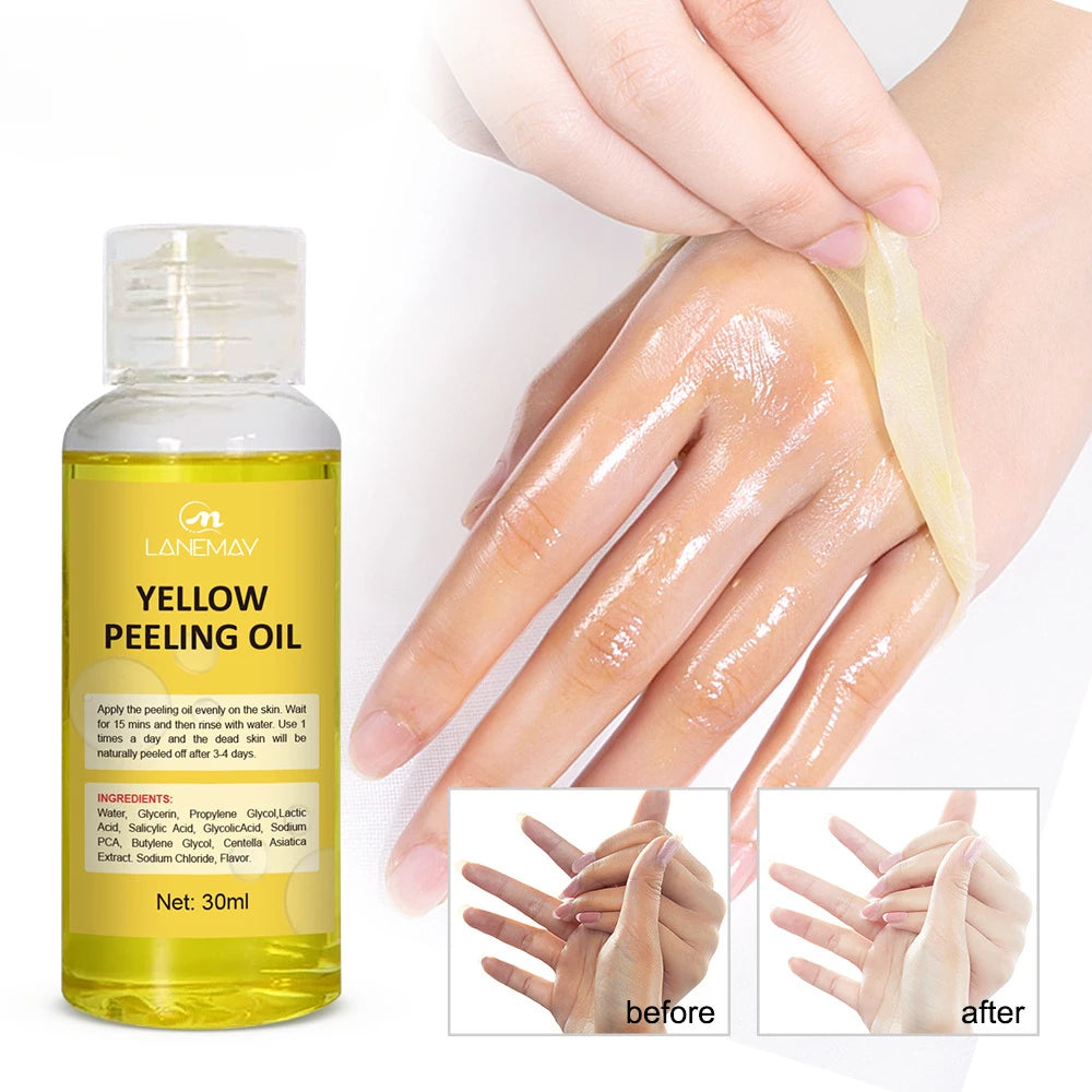 Yellow Peeling Oil Lighten Elbows Knees Hands Melanin Strong Yellow Peeling Oil Even Skin Tone And Whiten Skin Care Supplies Qme