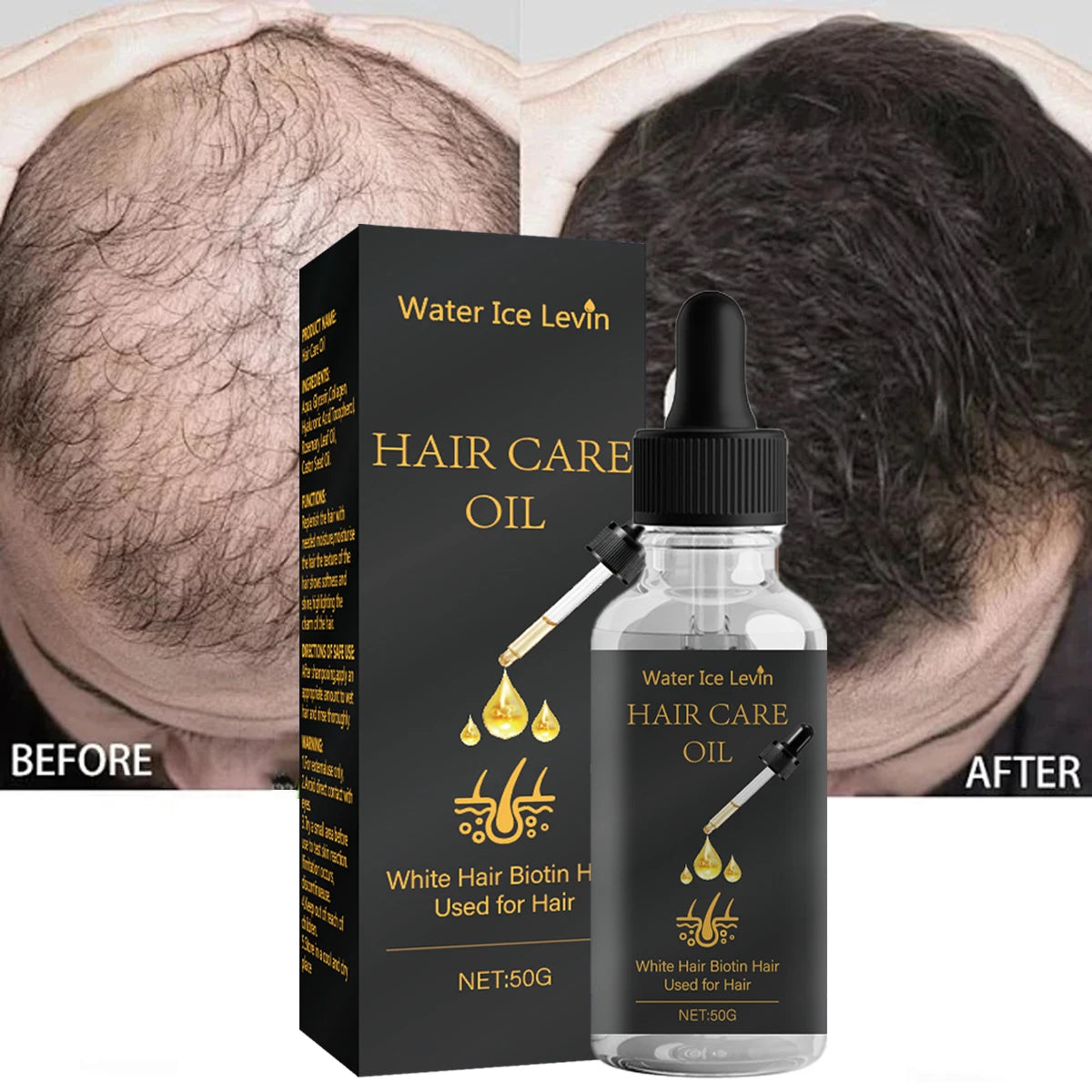 Hair Care Oil with Biotin - Fights White Hair & Boosts Moisture with Rosemary, Castor Oil, Collagen for Soft, Shiny Hair Qme