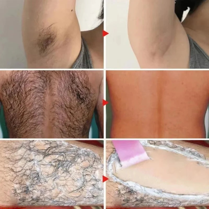 Permanent Hair Removal Cream Hair Growth Inhibitor Face Arm Armpit Leg Intimate Areas Painless Depilatory For Men Women Care Qme
