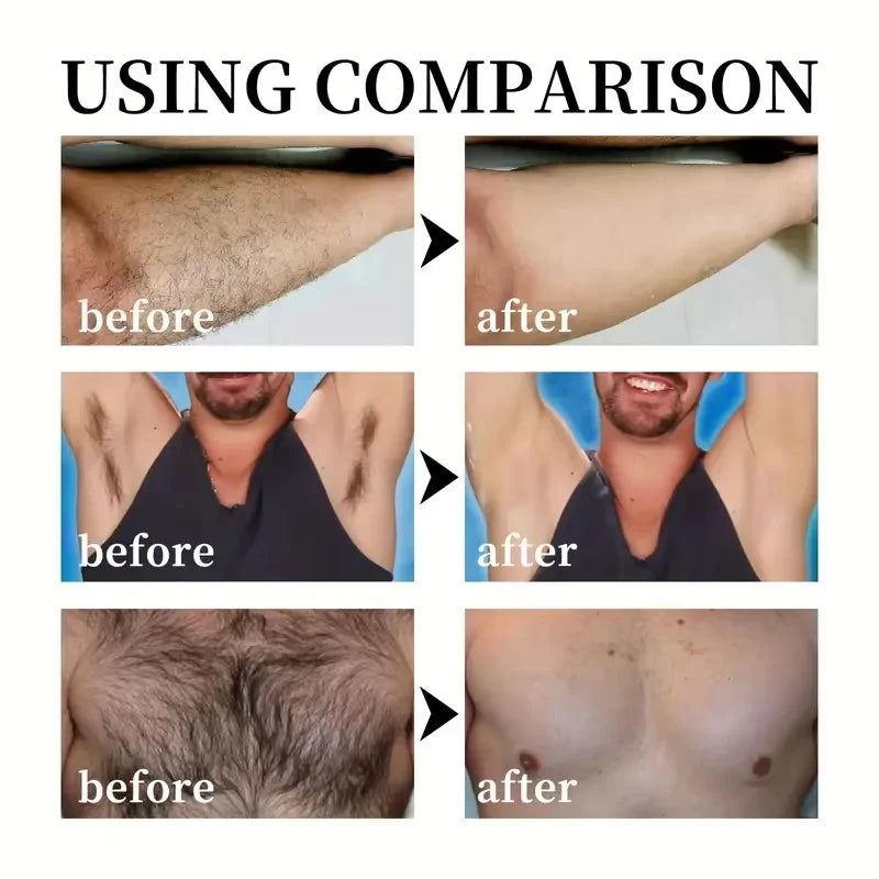 Permanent Hair Removal Cream Epilator Cream Intimate Areas Health Painless Hair Remover Growth Inhibitor Body Care For Woman Men Qme