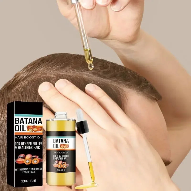 Batana Oil Spray Repairs Baldness Strengthens Hair Natural Nourishment Hereditary Loss Treatment,Moisturizes Scalp All Genders Qme