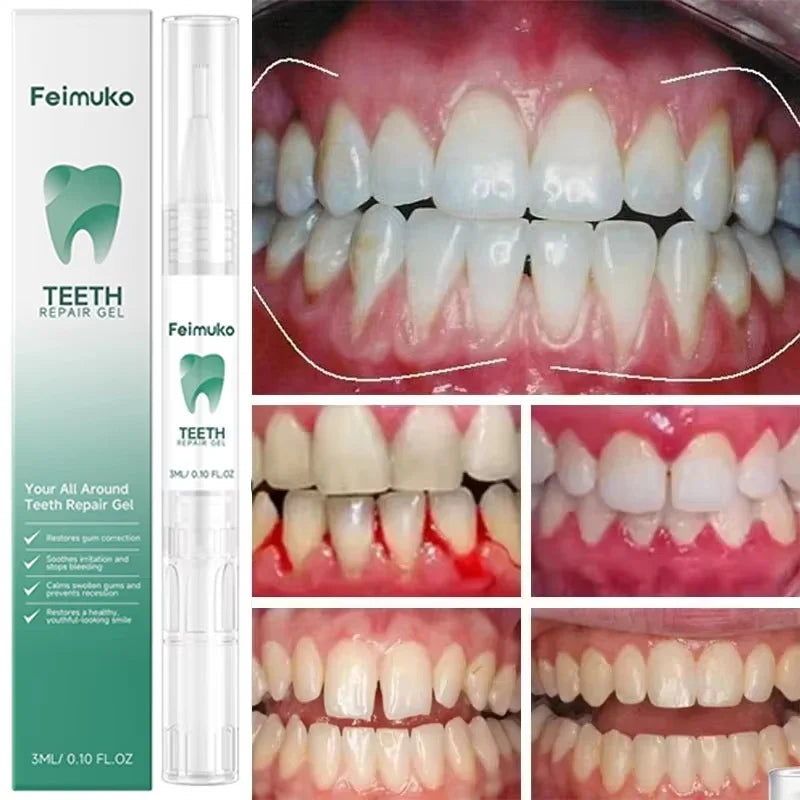Damaged Gum Repair Care Gel Relieve Sore Gums Allergy Deep Cleaning Teeth Stains Tartar Serum Dental Caries Toothpaste Qme