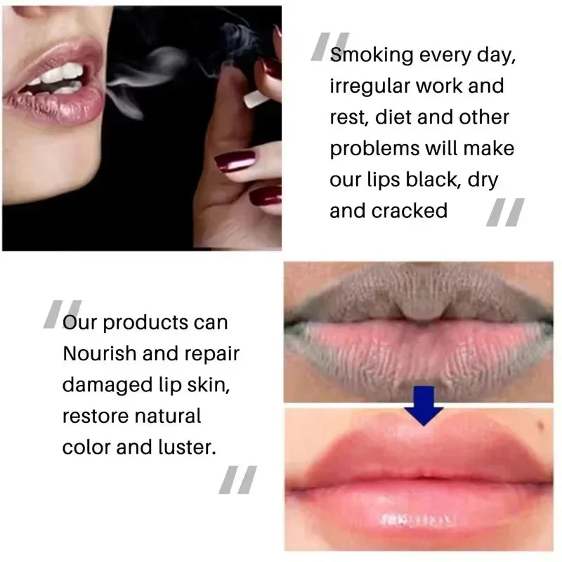 Remove Dark Smoke Lip Balm Lightening Melanin Bleaching Gloss Oil Lips Pink Lipstick Exfoliating Fade Lip Lines Korean Cosmetics Qme