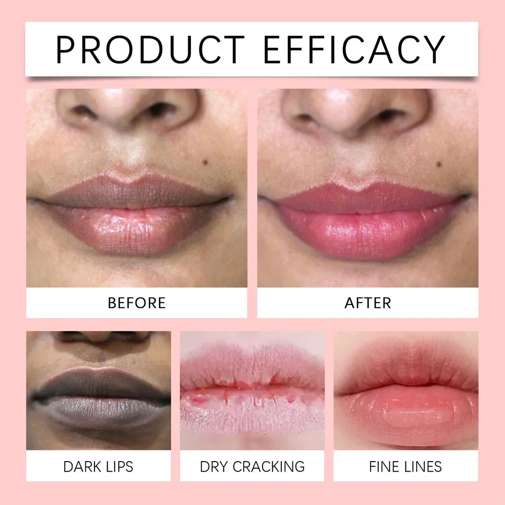 Remove Dark Lip Balm Fast Lightening Pink Lip Exfoliating Fade Lip Line Dead Skin Moisturizer Korean Care Products Beauty Health Qme