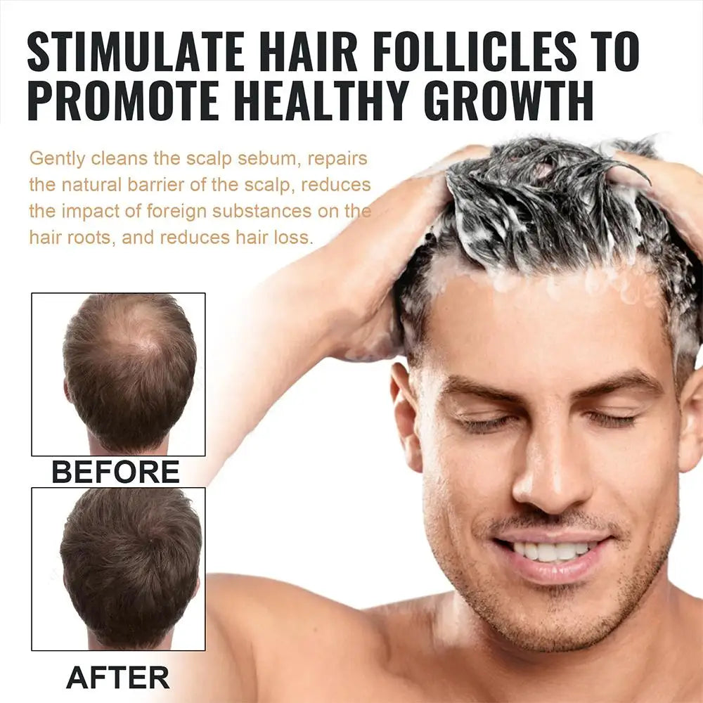 2PCS Anti Baldness Shampoo Thickening Shampoo Root Activator Shampoo Nourish Hair Regrowth Shampoo For Thinning Hair & Hair Loss Qme
