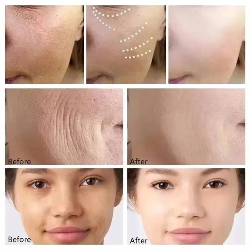 Instant Wrinkle Remover Face Serum Lifting Firming Fade Fine Lines Anti-aging Essence Whitening Brighten Nourish Skin Care Qme