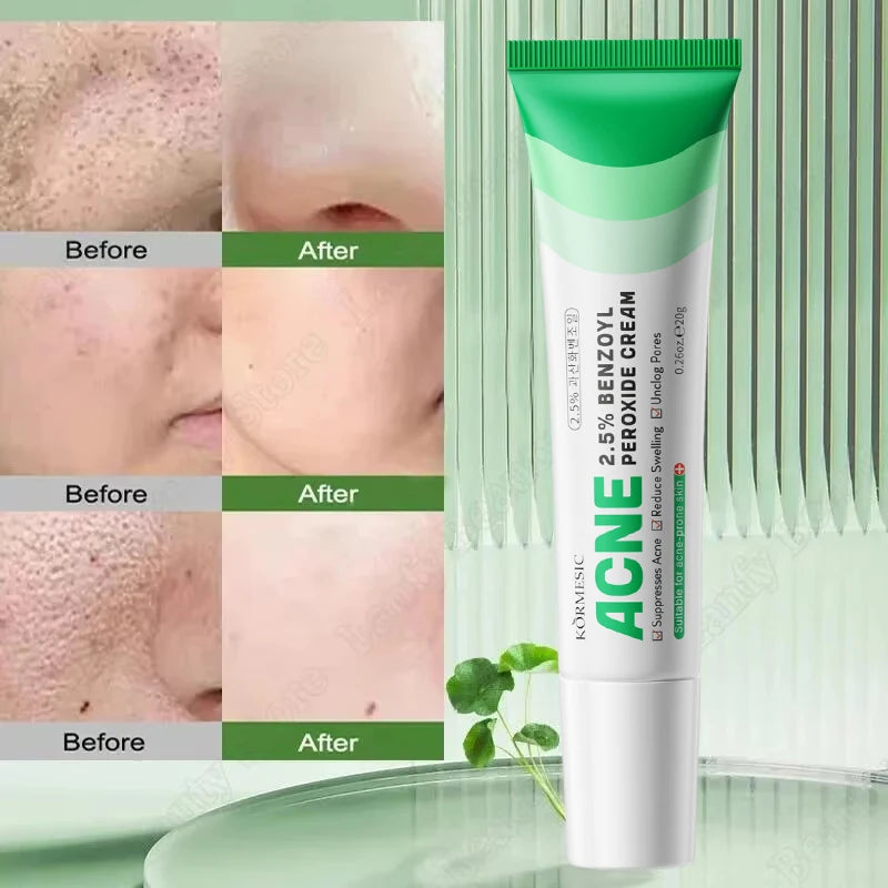 Salicylic Acid Pore Clearing Cream Shrink Pores Remove Blackheads Acne Brighten Moisturizing Smooth Skin Care Korean Products Qme