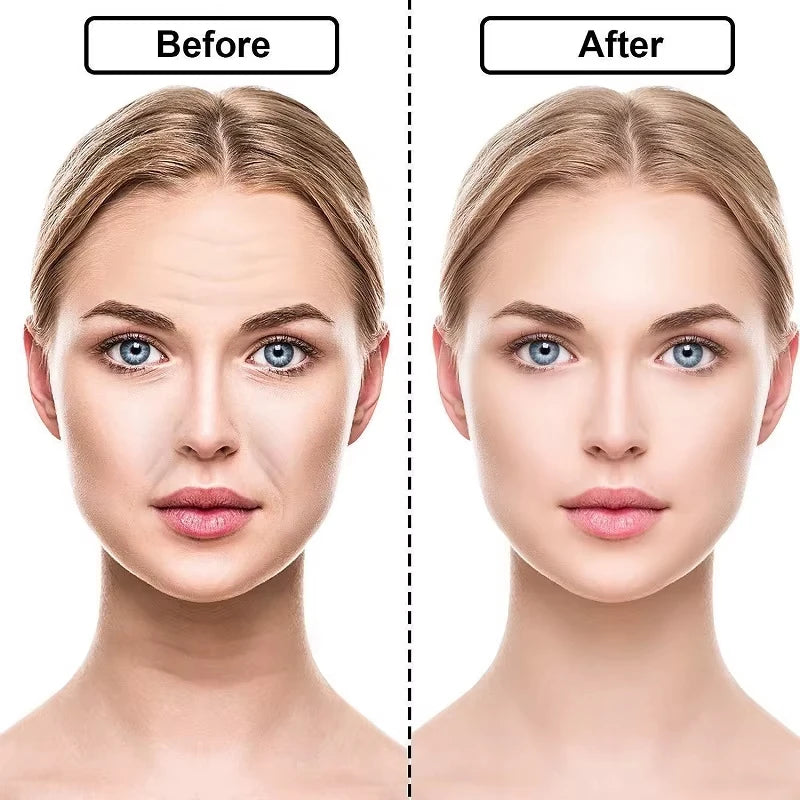 Anti Wrinkle Forehead Patch Silicone Reusable Soft Comfortable Easy Qme