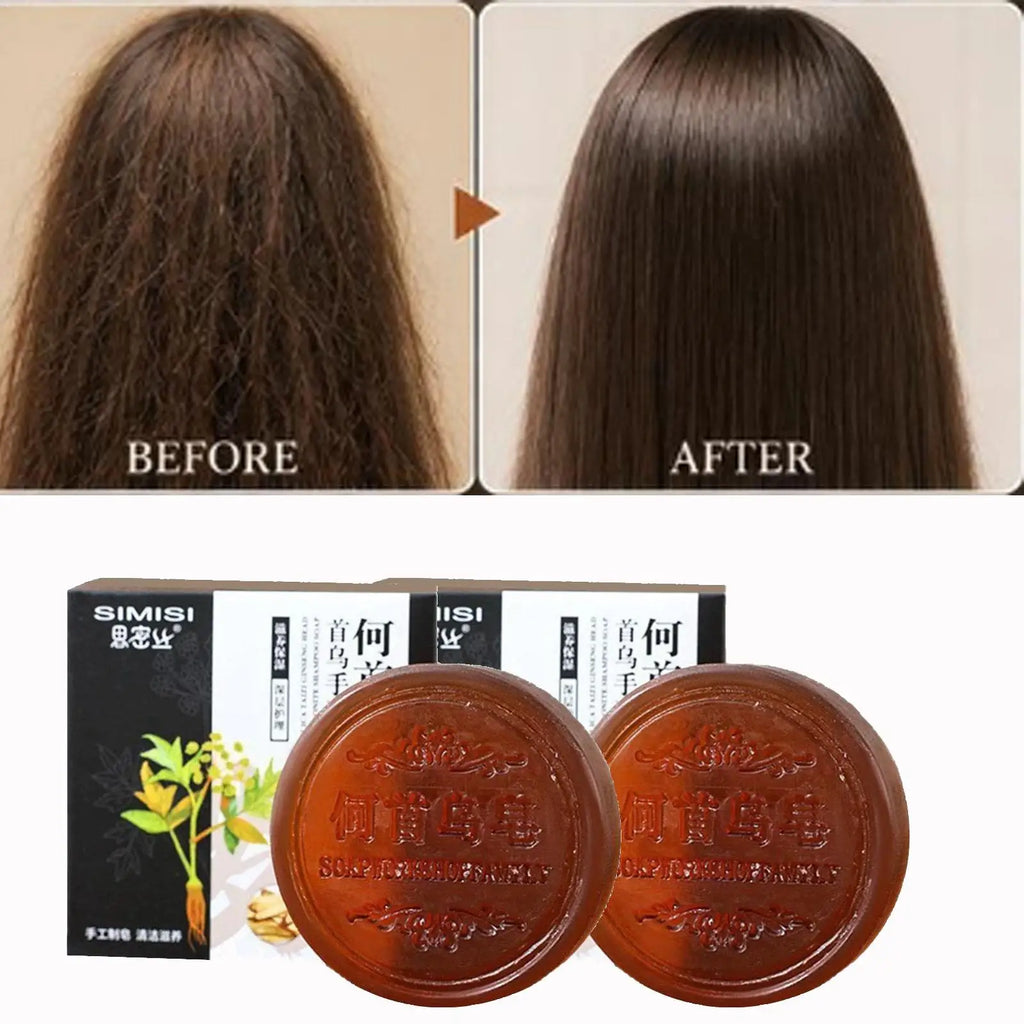 Traditional Hair Care Soap Face Wash Soap, Oil Control, Blackhead Remover, Gentle Cleansing For Men Women, Daily Skin Care Qme