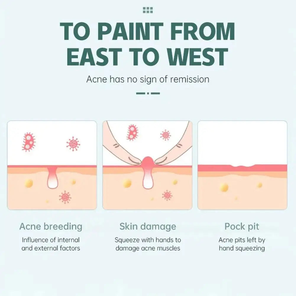 24pcs Anti-ance Patch Hydrocolloid Acne Pimple Removal Sticker Gentle Repair Oil Control Breathable Soothing Facial Care Qme