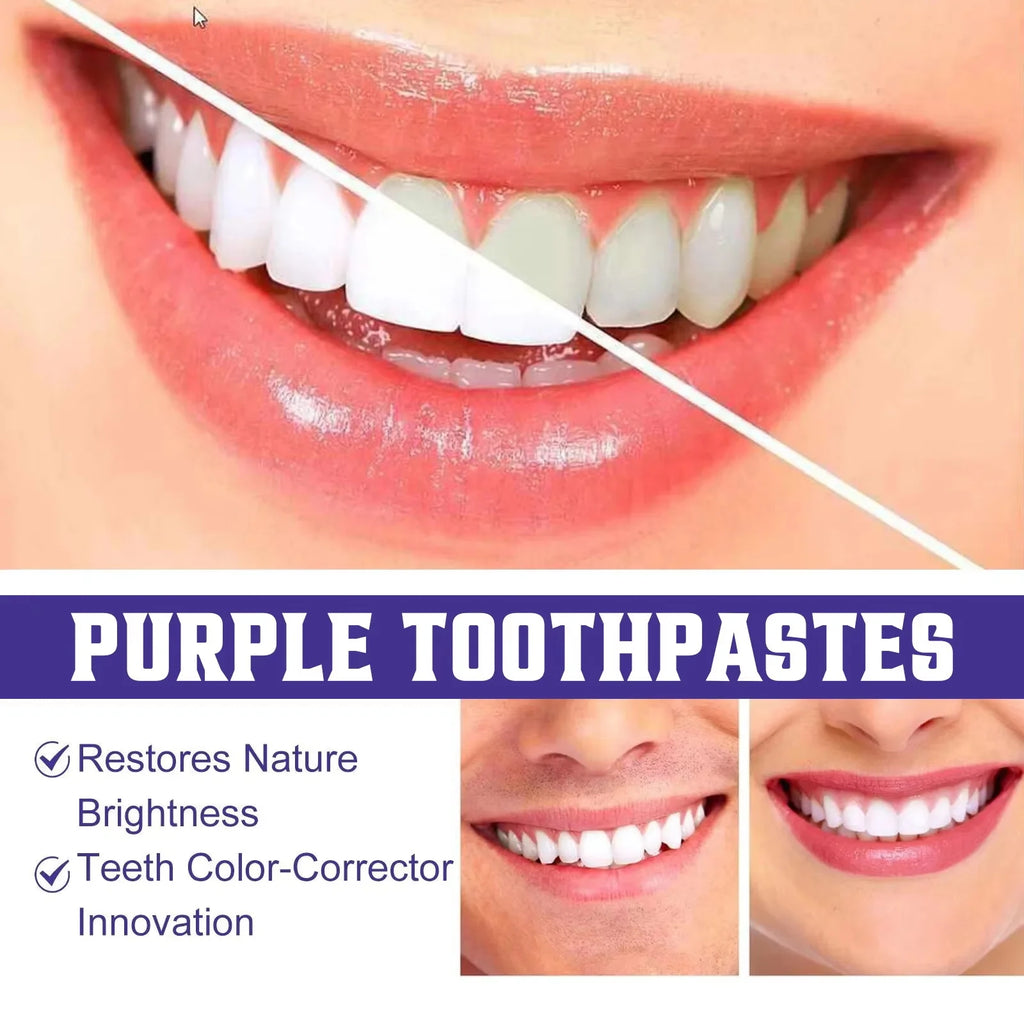 Teeth Removing Deep Smoke Stains Gingiva Protection Purple Orthopedic Toothpaste Effectively Cleans Oral Cavity Brightens Qme
