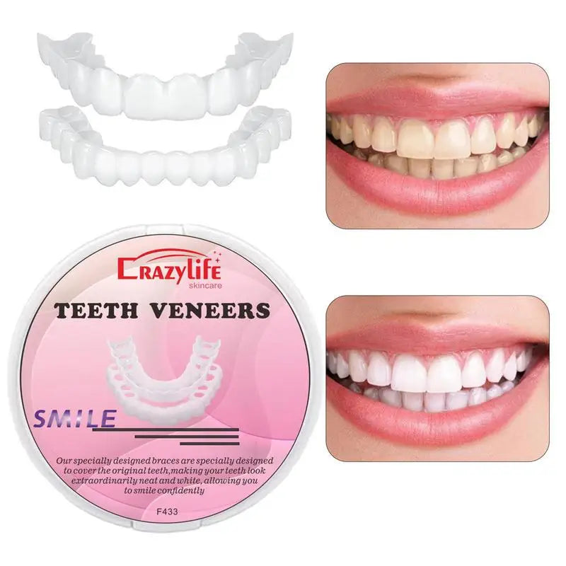 Teeth Veneers Tooth Cover Dentures Dental Snap Fake Instant Qme