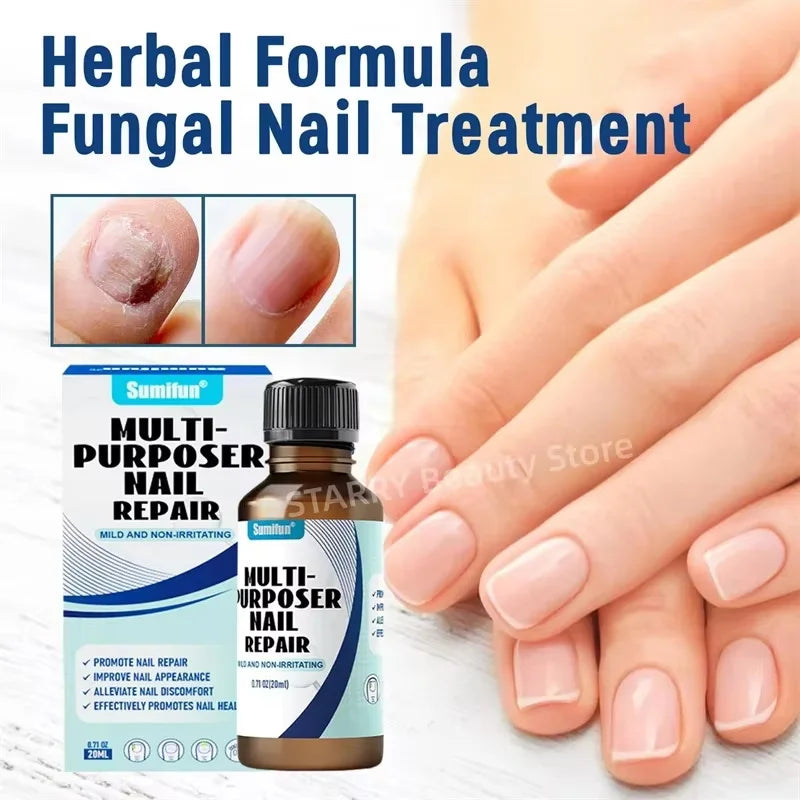 Fungal Nail Treatment Serum Foot Nail Fungus Removal Repair Gel Anti Infection Paronychia Onychomycosis Foot Nails Care Essence Qme 1pc