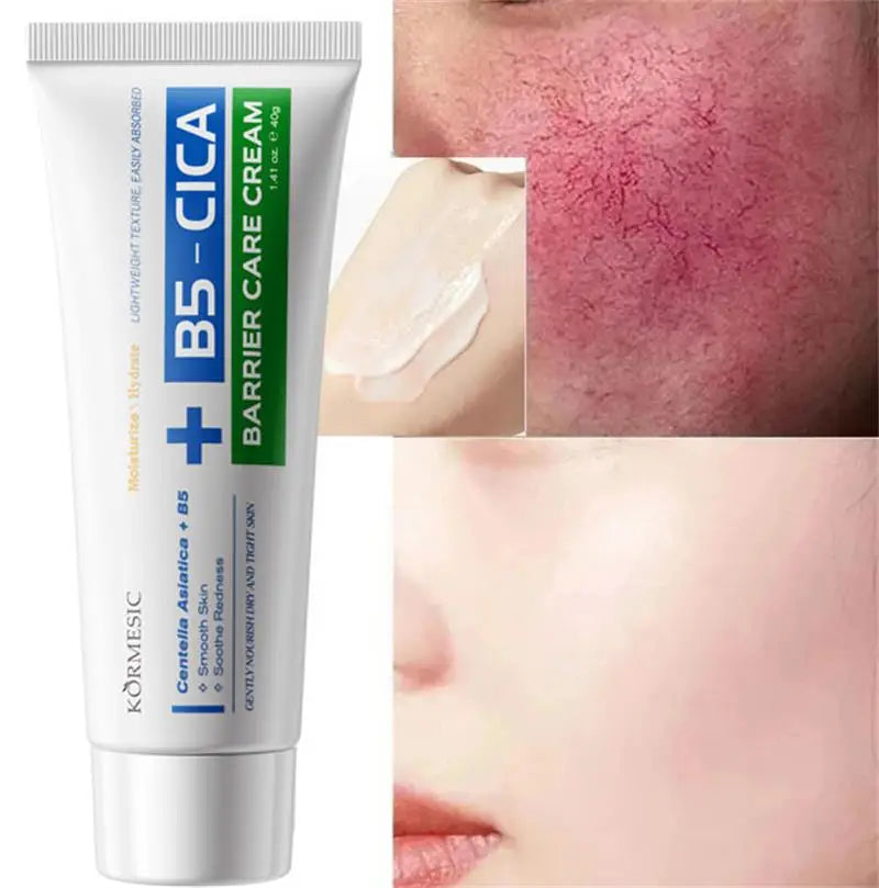B5 Repair Cream Moisturizing Hydrating Soothing Dry Chapped Redness Skin Nourishes Hydrating Barrier Support Beauty Face Cream Qme 1pc