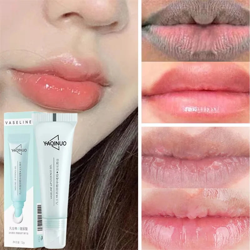 Remove Dark Lip Balm Fast Lightening Pink Lip Exfoliating Fade Lip Line Dead Skin Moisturizer Korean Care Products Beauty Health Qme