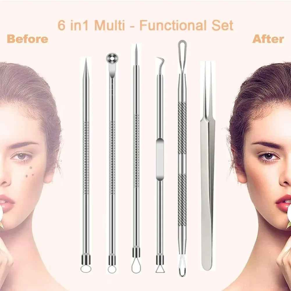 Stainless Steel Blackhead Remover Tools Comedone Extractor Tweezers Qme