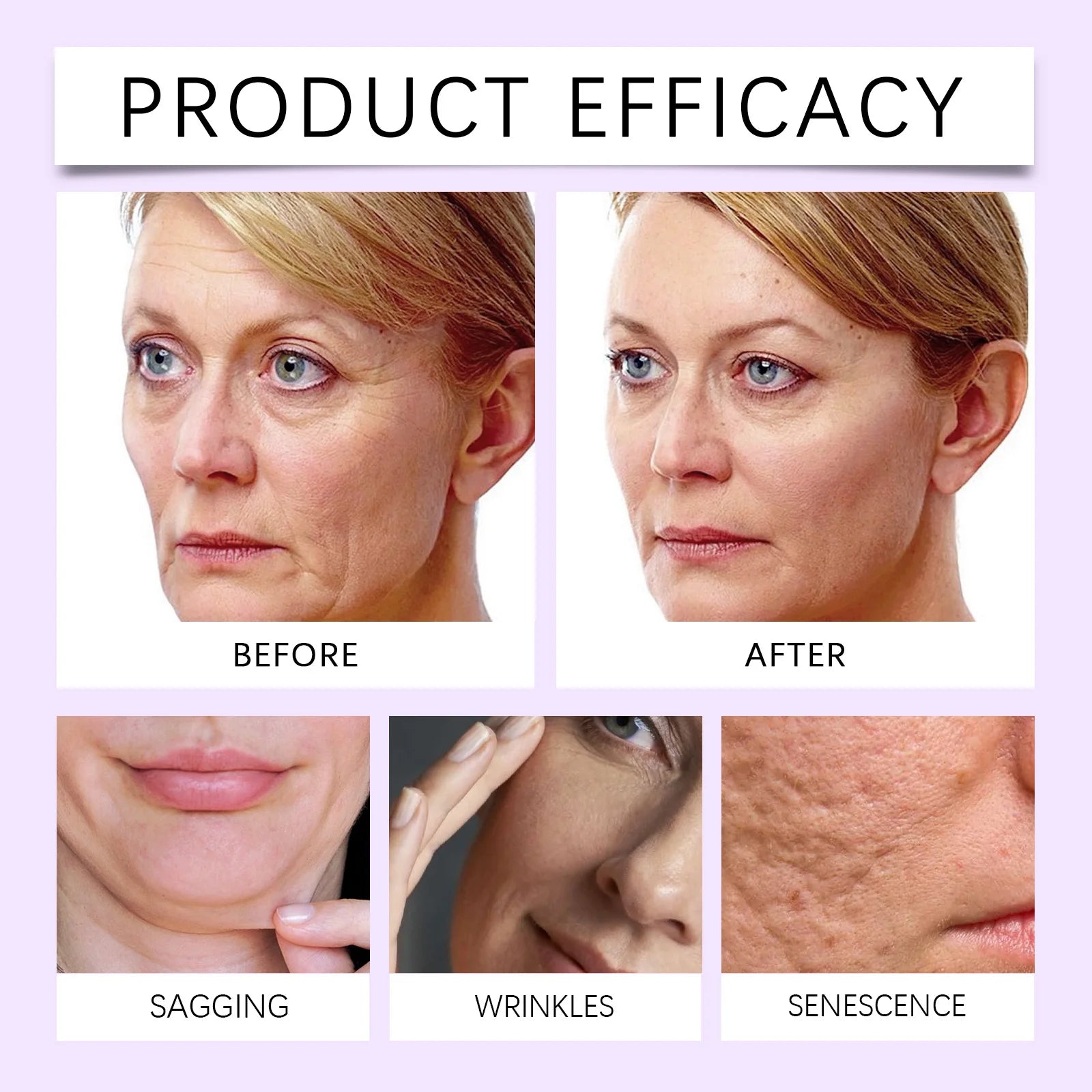 Niacinamide Facial Serum Vitamin B3 Wrinkles Pigment Dark Spot Removal Correcting Glow Serum Face Whitening Moisturizer Serum Qme