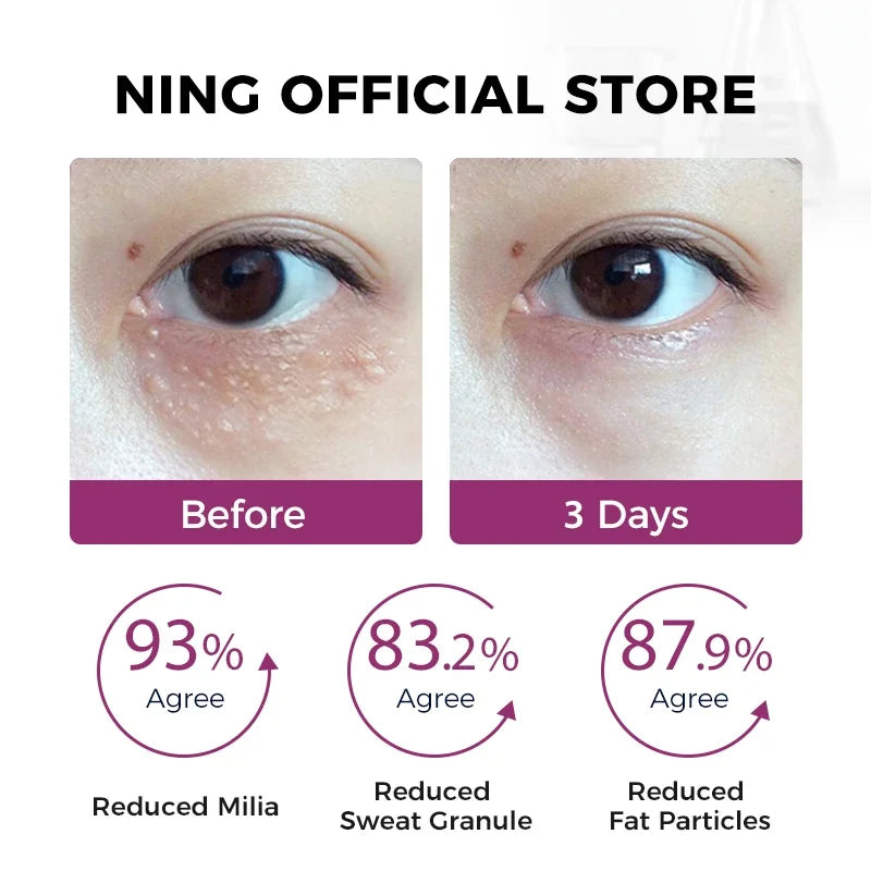 NING Lifting Tightening Eye Essence Zinc Fermented Yeast Peptides Qme