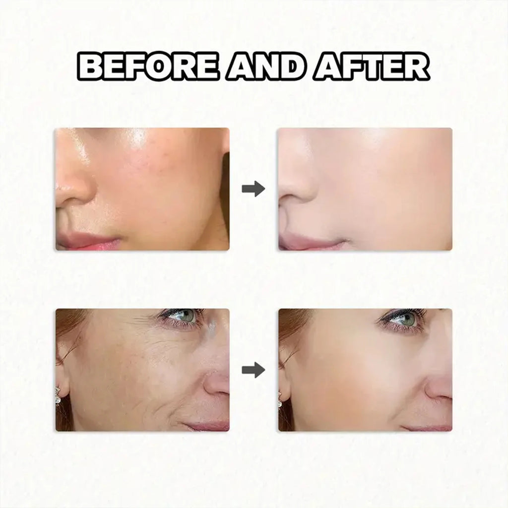 Age-less Serum with Bee Venom & Retinol - Moisturizing & Brightening Formula for Softer, Confident Skin Qme