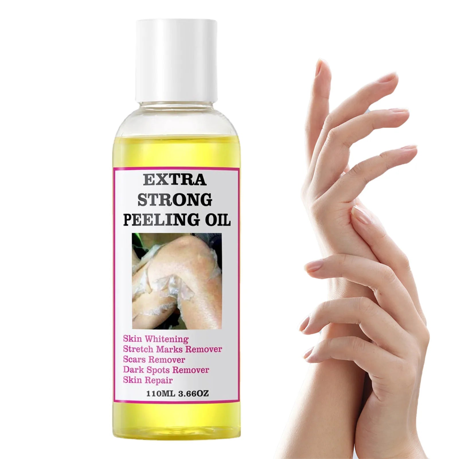 Peeling Oil Yellow Dark Spots Body Thai Hyaluronic Acid Strong Extra Qme