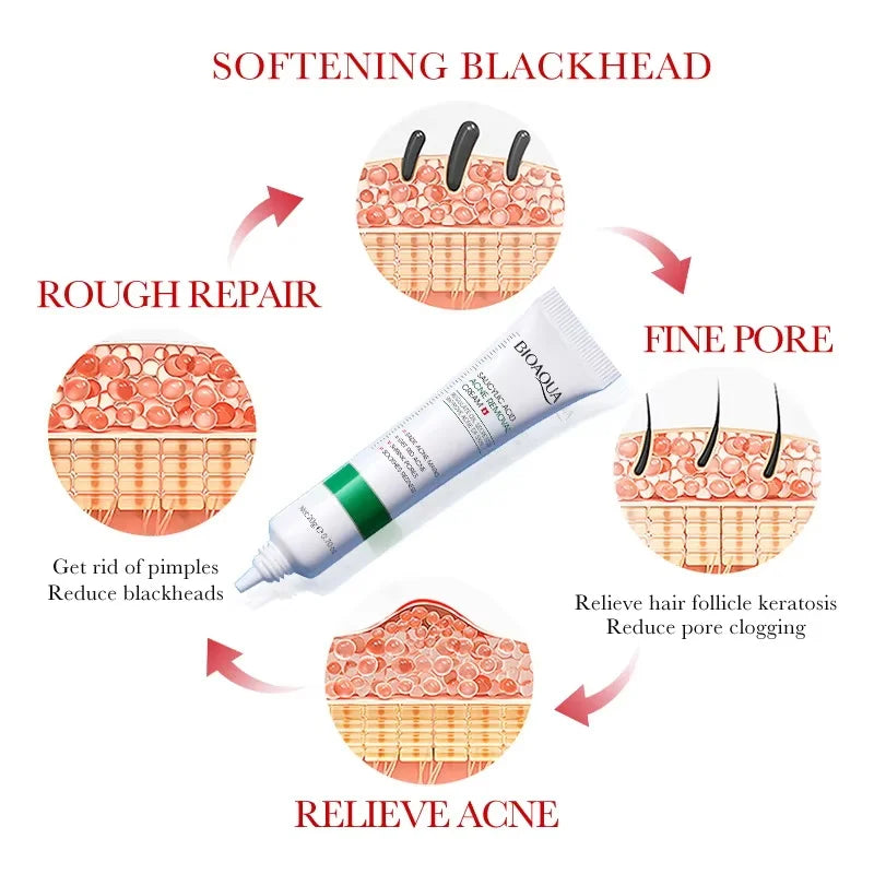Salicylic Acid Shrink Pore Cream Elimination Large Pores Remove Blackehead Oil Control Face Smooth Repairing Skin Care Products Qme