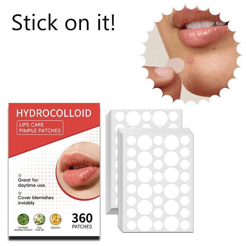 Mouth Blister Patch Cold Sore Lip Healing Hydrocolloid Care Stickers Qme