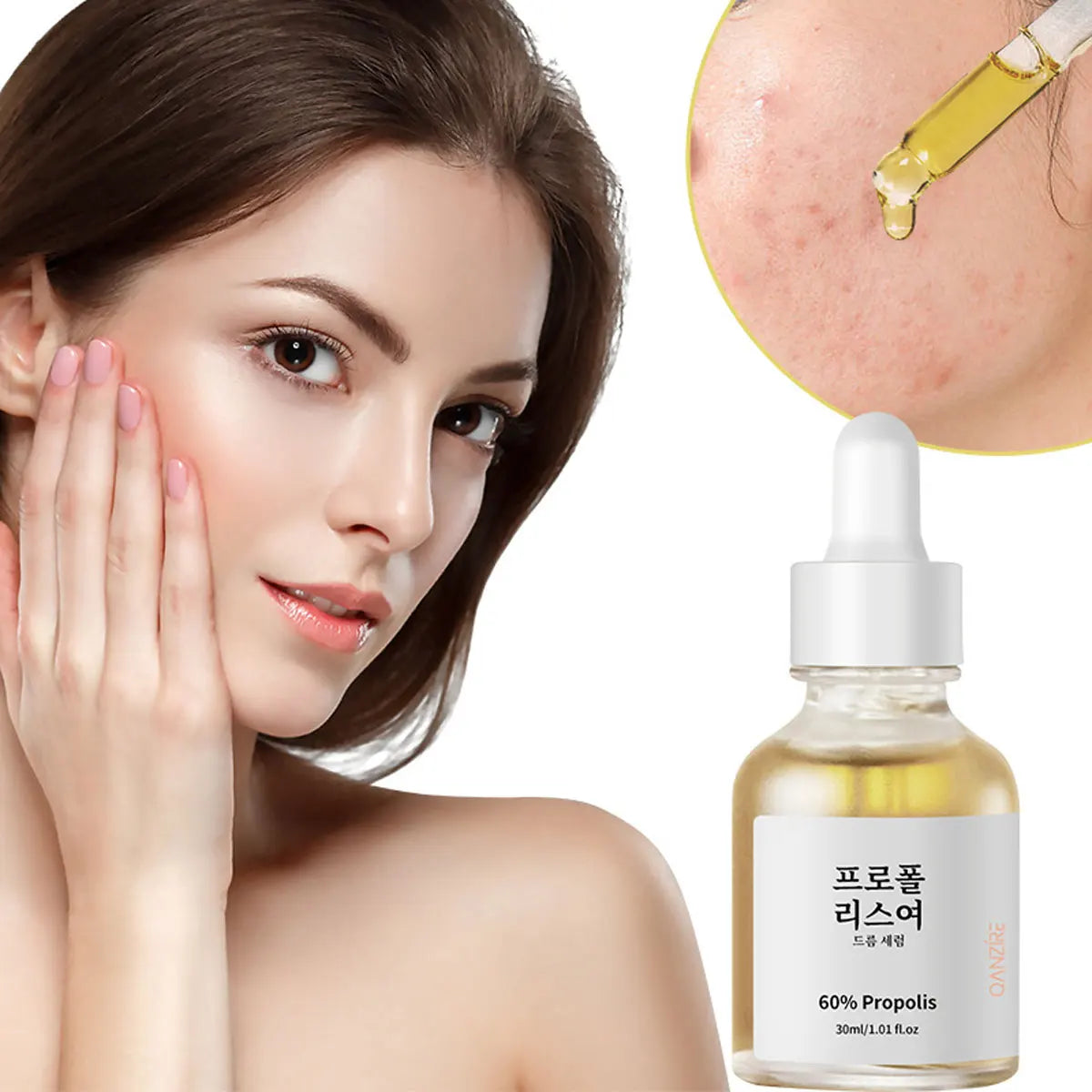 Propolis Salicylic Acid Acne Treatment Essence Pore Refining Qme